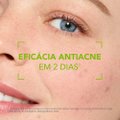 CORRETOR ANTIACNE E ANTIMARCAS - BIODERMA SÉBIUM KERATO+ 30ML