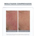 CREME FACIAL ANTIVERMELHIDÃO EUCERIN PELES SENSÍVEIS ANTI-REDNESS COM COR FPS30 50ML