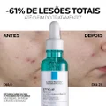 SÉRUM FACIAL ANTIACNE LA ROCHE-POSAY EFFACLAR ULTRA CONCENTRADO PARA PELE OLEOSA 30ML