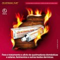 QUEIMALIVE POMADA 30GR