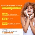 SABONETE EM BARRA ACTINE PELE ACNEICA 70G