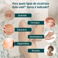 SPRAY PARA CICATRIZES KELO-COTE 100ML