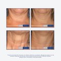 CREME ANTISSINAIS PARA PESCOÇO E COLO NEOSTRATA SKIN ACTIVE TRIPLE FIRMING NECK CREAM 80G