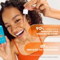 SÉRUM FACIAL DARROW ACTINE CARE ANTI-ACNE 30G