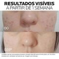 CREME PARA ÁREA DE OLHOS LA ROCHE-POSAY MELA B3 ANTIMANCHAS 15ML