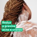 SABONETE LÍQUIDO CORPORAL DOVE ACNE CONTROL 547ML