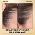 SHAMPO PANTENE BIOTINAMINA B3 ANTIQUEDA 510ML