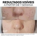 SÉRUM FACIAL LA ROCHE-POSAY MELA B3 ANTIMANCHAS 15ML
