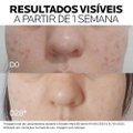 SÉRUM FACIAL LA ROCHE-POSAY MELA B3 ANTIMANCHAS 30ML