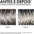 SHAMPOO VICHY DERCOS ANTICASPA DS 300G