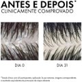 SHAMPOO VICHY DERCOS ANTICASPA DS 300ML