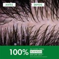 SHAMPOO VICHY DERCOS ANTICASPA DS REFIL 200ML