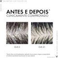 SHAMPOO VICHY DERCOS ANTICASPA DS REFIL 200ML