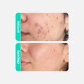 GEL CREME NOTURNO GLICOINTENSE PEEL CREAMY 30G