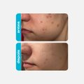 CREME RETEXTURIZADOR CREAMY ÁCIDO GLICÓLICO 30G