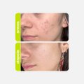 TÔNICO CLAREADOR CREAMY ÁCIDO TRANEXÂMICO 90ML