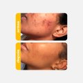 SÉRUM FACIAL HIDRATANTE RENOVADOR CREAMY ÁCIDO LÁTICO 5% + NIACINAMIDA 5% 30ML
